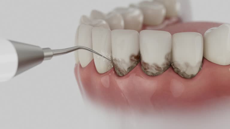 Reliable Dental contractor in Benicia, CA by Smile Center Dentistry